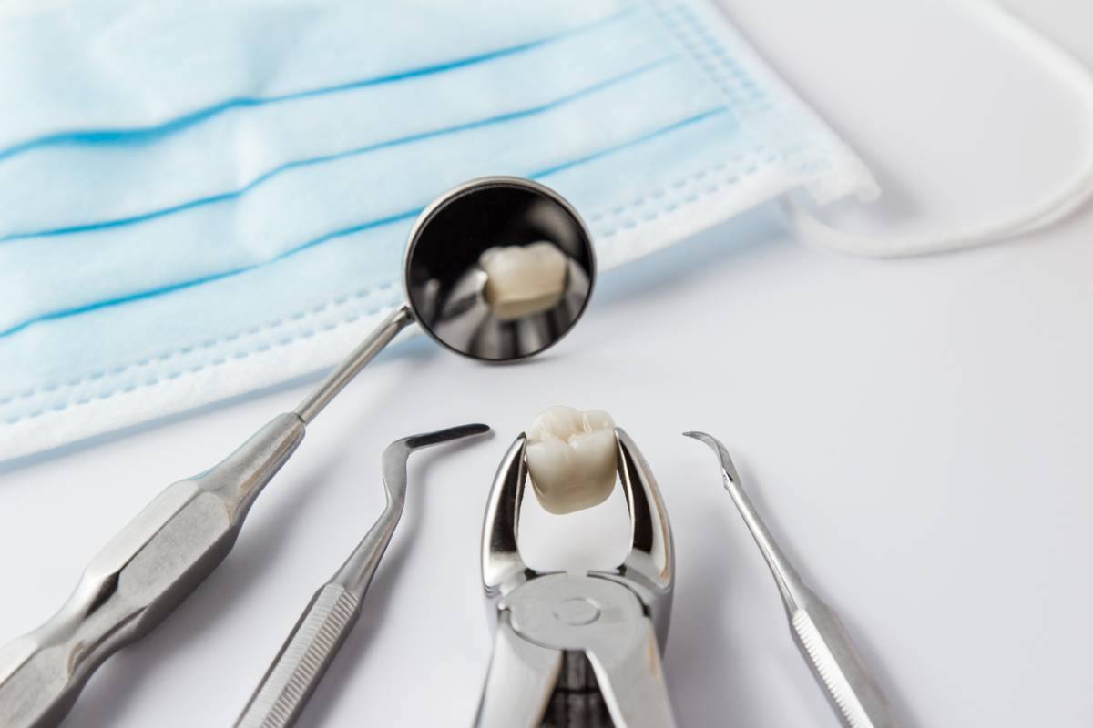 Featured image for How Do You Know If You Need a Tooth Extraction