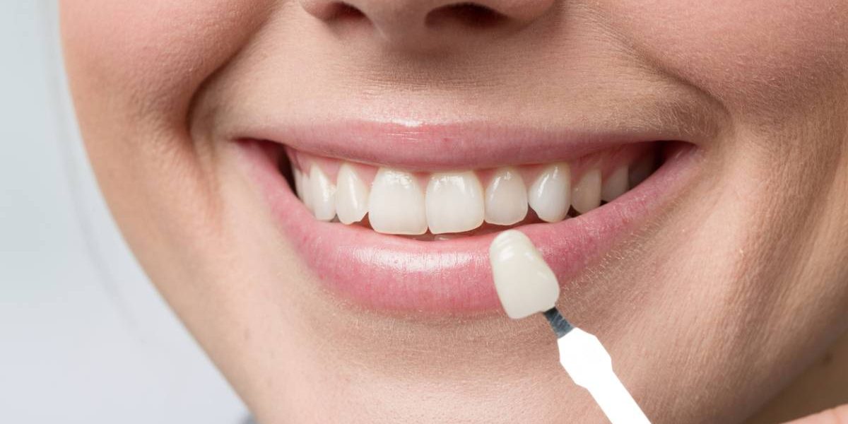 Choosing filling shade for smiling patient.